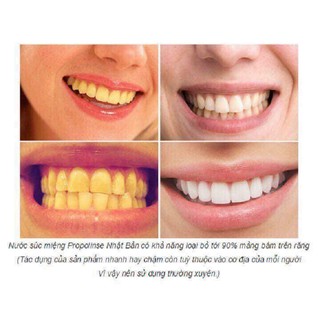 NƯỚC SÚC MIỆNG PROPOLINSE 600ml