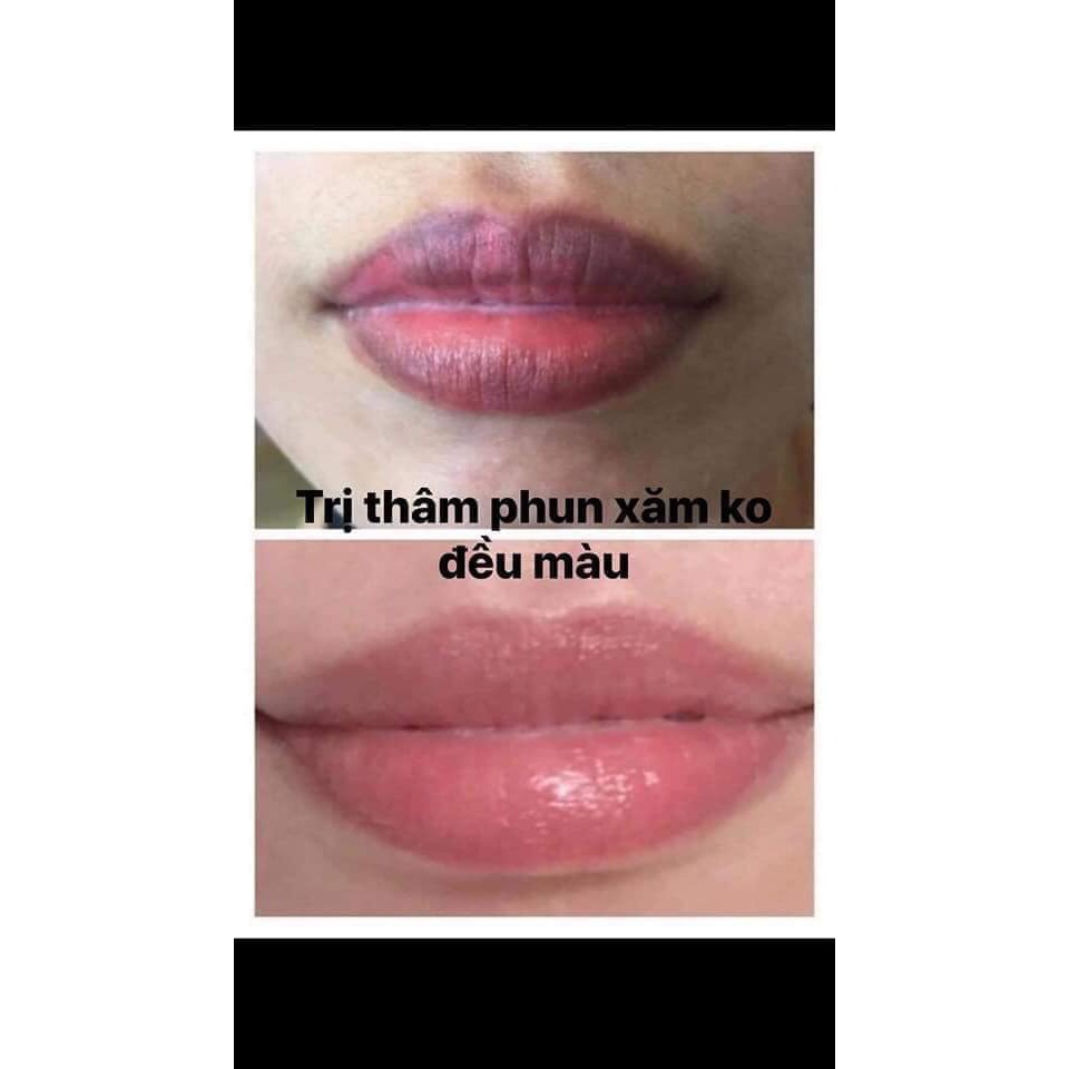[FREESHIP] Kem khử thâm làm hồng môi Hàn Quốc Xxvirgin 5ml có tác dụng sau 5 ngày | BigBuy360 - bigbuy360.vn