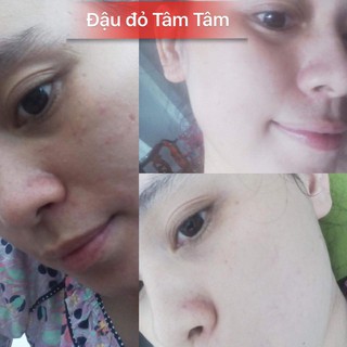 Bột Đậu đỏ dưỡng da Tâm Tâm