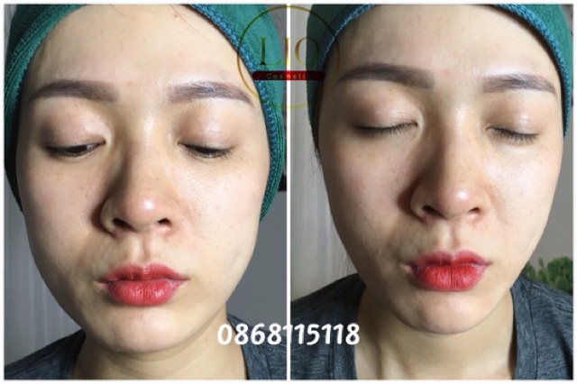 Xịt nâng cơ Lio nâng cơ ngay sau khi xịt | BigBuy360 - bigbuy360.vn