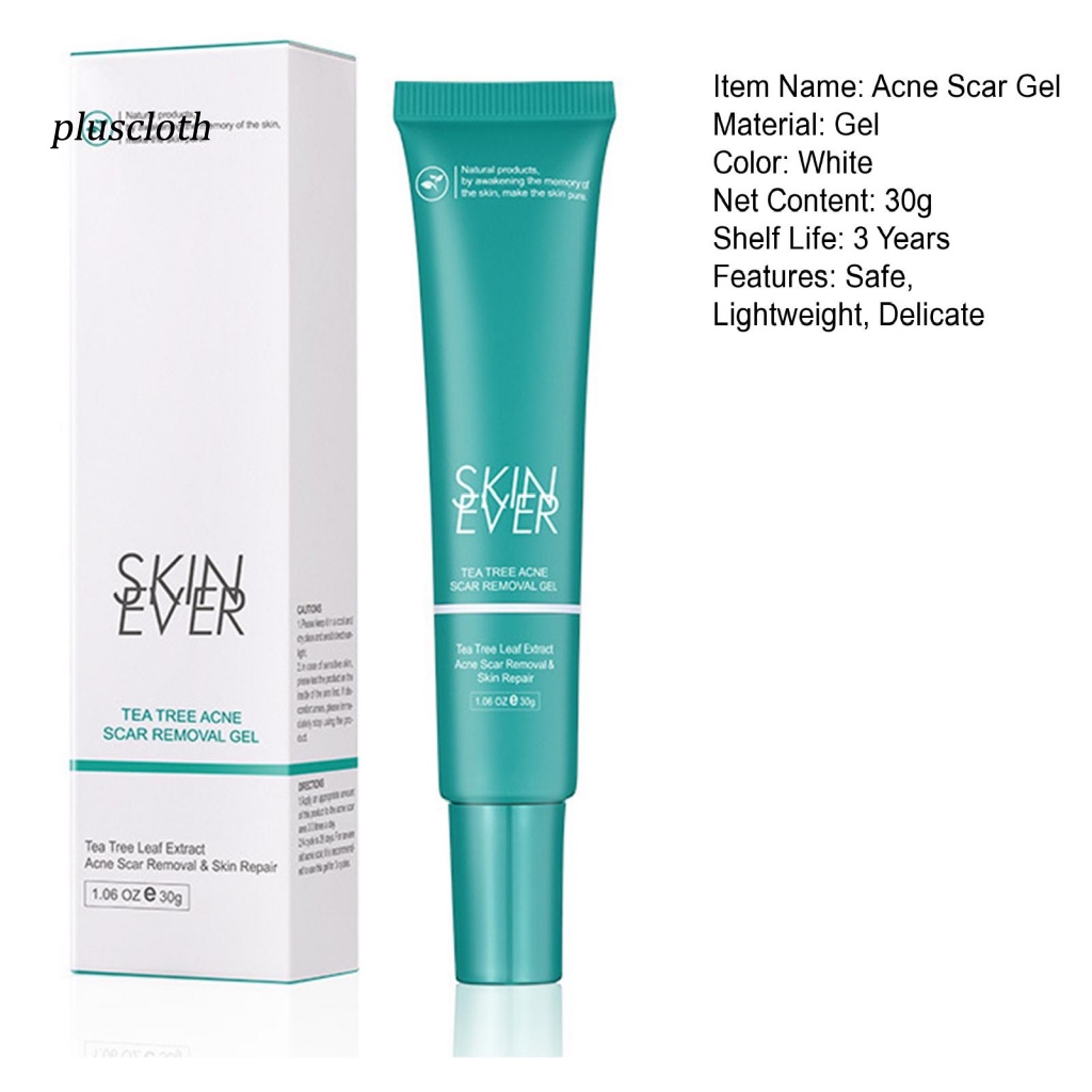 Tuýp Kem Hỗ trợ giảm mụn Trứng Cá Chăm Sóc Da Mặt 30g