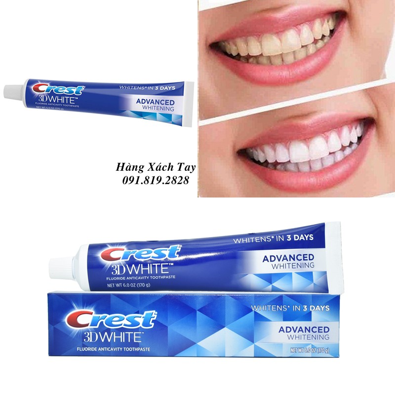 KEM ĐÁNH RĂNG CREST 3D WHITE ADVANCED WHITENING