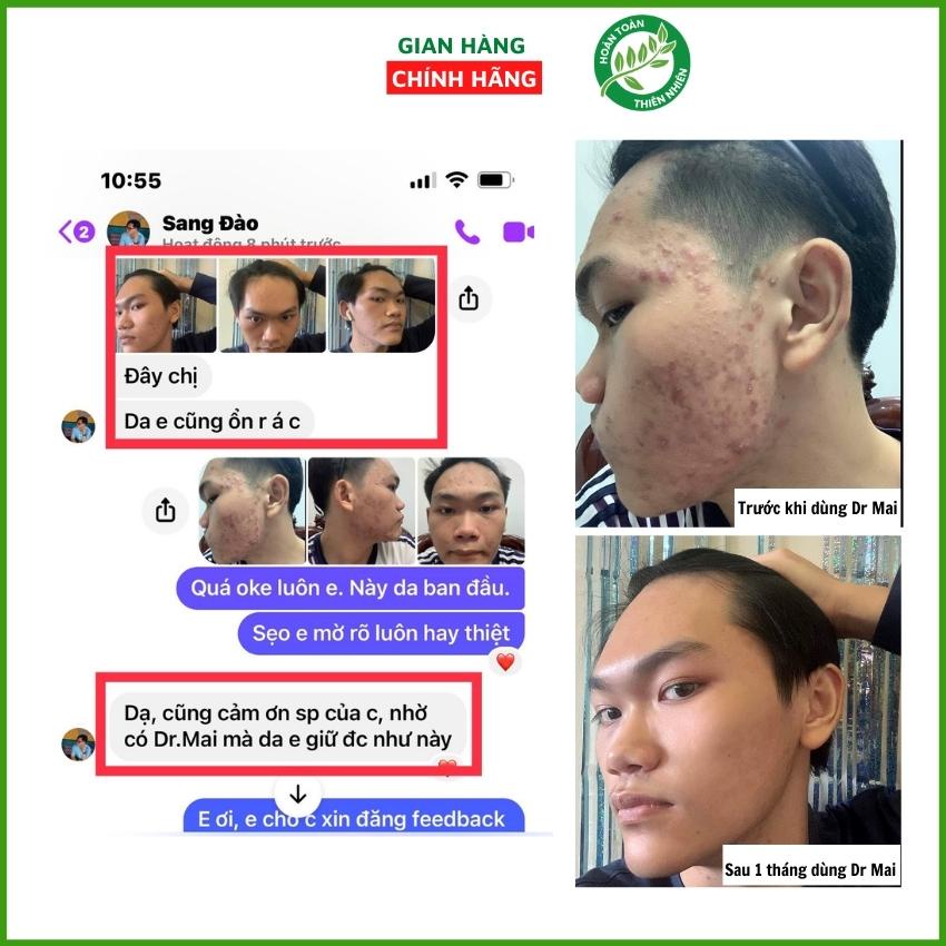 Dr Mai Combo sữa rửa mặt và serum sạch mụn Dr Mai đánh bay mụn mờ thâm thu nhỏ lỗ chân lông dưỡng da căng bóng