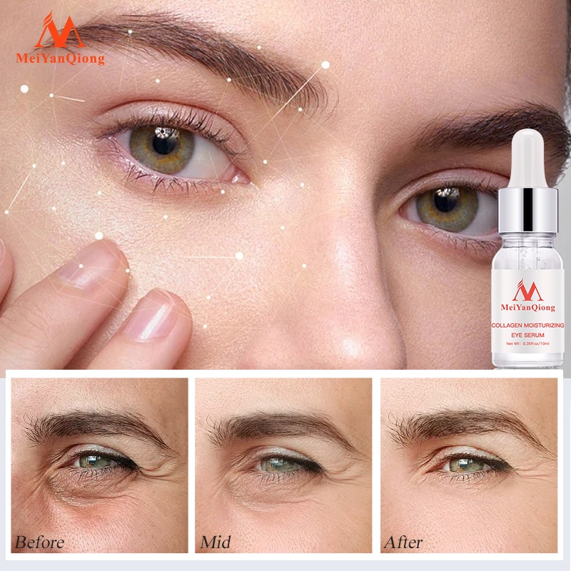 MeiYanQiong Tái TạoTinh Chất Dưỡng Da Vùng Mắt Chống Lão Hóa Loại Bỏ Nếp Nhăn Rejuvenating eye Serum12ml