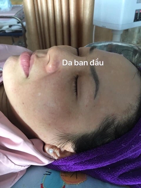 Bột Mầm Tái Sinh Gói Lẻ