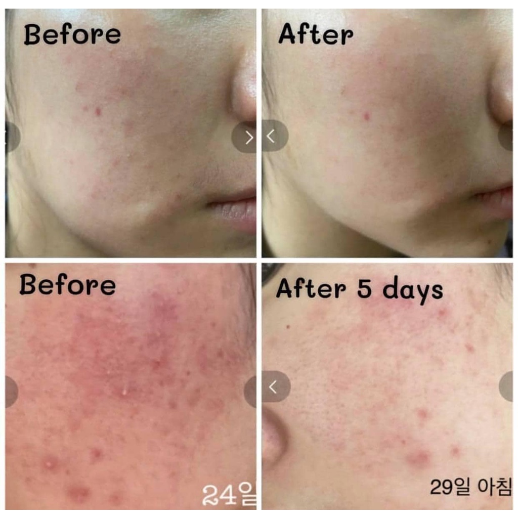 Tinh Chất B5 Dưỡng Ẩm Make P:rem Comfort Me Panthenol Moisture Essence