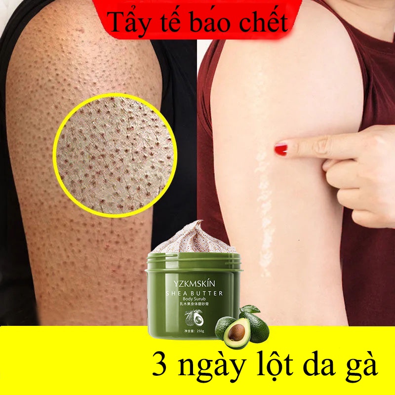 Tẩy da chết body 250g tẩy tế bào chết cơ thể YZKMSKIN làm trắng da toàn thân Làm cho da mịn màng và mềm mại | BigBuy360 - bigbuy360.vn