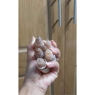 Viêm Xoang, Viêm Mũi Dị Ứng
