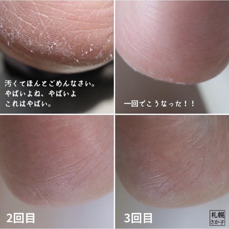 Tẩy da chết gót chân One-Day s You Gak Zil Ssg Ssg Help Me Foot Peeling | BigBuy360 - bigbuy360.vn