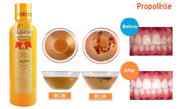 Nước Súc Miệng Propolinse Chiết Xuất Trà Xanh