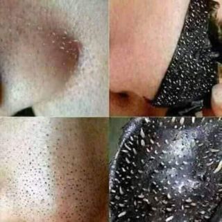 Gel Lột Mụn Than Tre