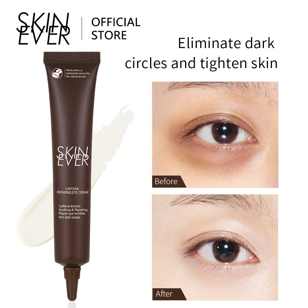 Kem dưỡng da quanh mắt SKIN EVER giảm quầng thâm/ nếp nhăn hiệu quả 20g | BigBuy360 - bigbuy360.vn