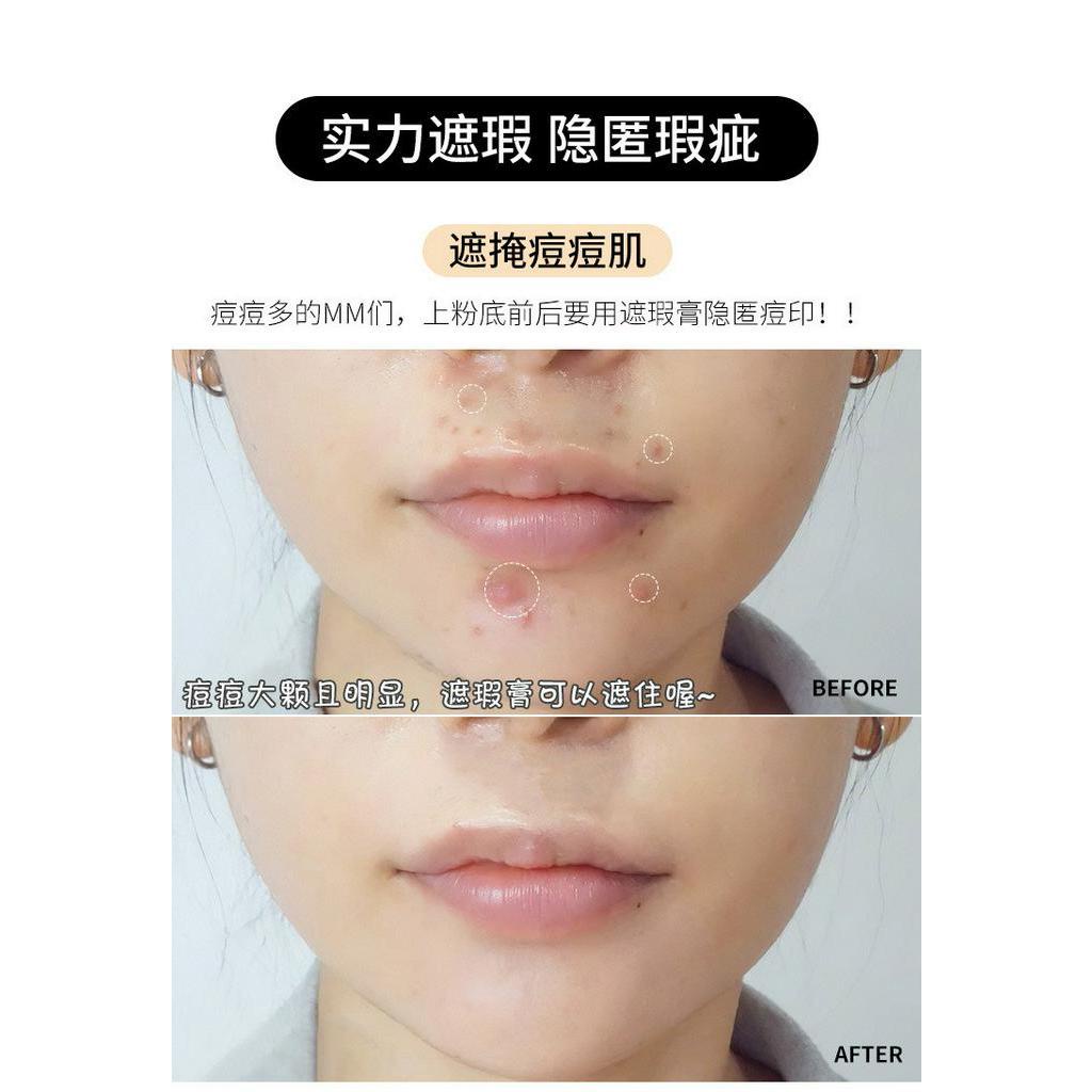 [Hàng mới về] Kem Nền Che Khuyết Điểm Có Độ Che Phủ Cao Làm Sáng Da Và Che Phủ Quầng Thâm Hiệu Quả