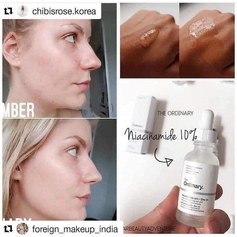 Tinh Chất Serum The Ordinary Niacinamide 10% + ZinC 1% | BigBuy360 - bigbuy360.vn