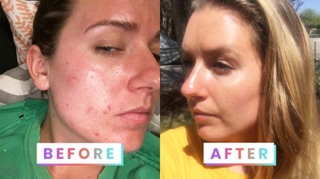 Nước cân bằng PIXI glow tonic