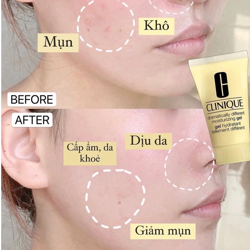 Kem lót Clinique Gel Dưỡng Ẩm tuýp 30ml chính hãng