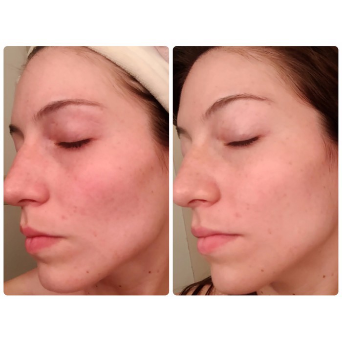 Tinh chất ốc sên giảm mụn, tái tạo da Images – SVN