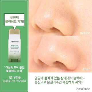 THANH LĂN MỤN ĐẦU ĐEN MAMONDE