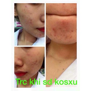 Moshroom serum KOSXU -HÀN QUỐC