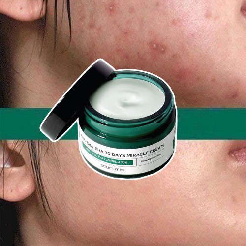 Kem Dưỡng Ngăn Ngừa Mụn Some By Mi AHA BHA PHA 30 Days Miracle Cream 50ml