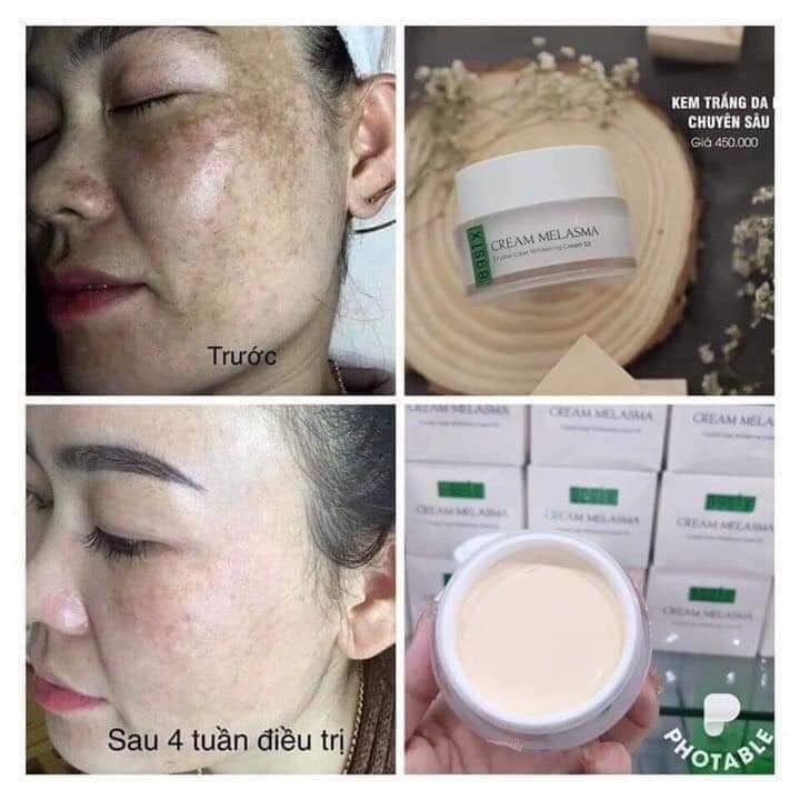 Kem nám nhật bản TATU S2 30gr Dưỡng Trắng Da chuyên sâu ngăn ngừa nám mới hình thành