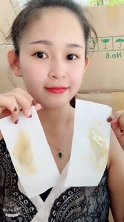 Combo mỡ trăng +was lông