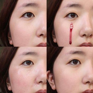 Serum thay da sinh học red peel, tinh chất trắng da