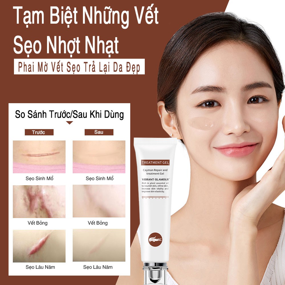 VIBRANT GLAMOUR KEM LÀM MỜ SẸO LÀM MỜ SẸO DO MỤN PHỤC HỒI VÀ TÁI TẠO DA MỜ RẠN DA SAU SINH SCAR TREATMENT GEL