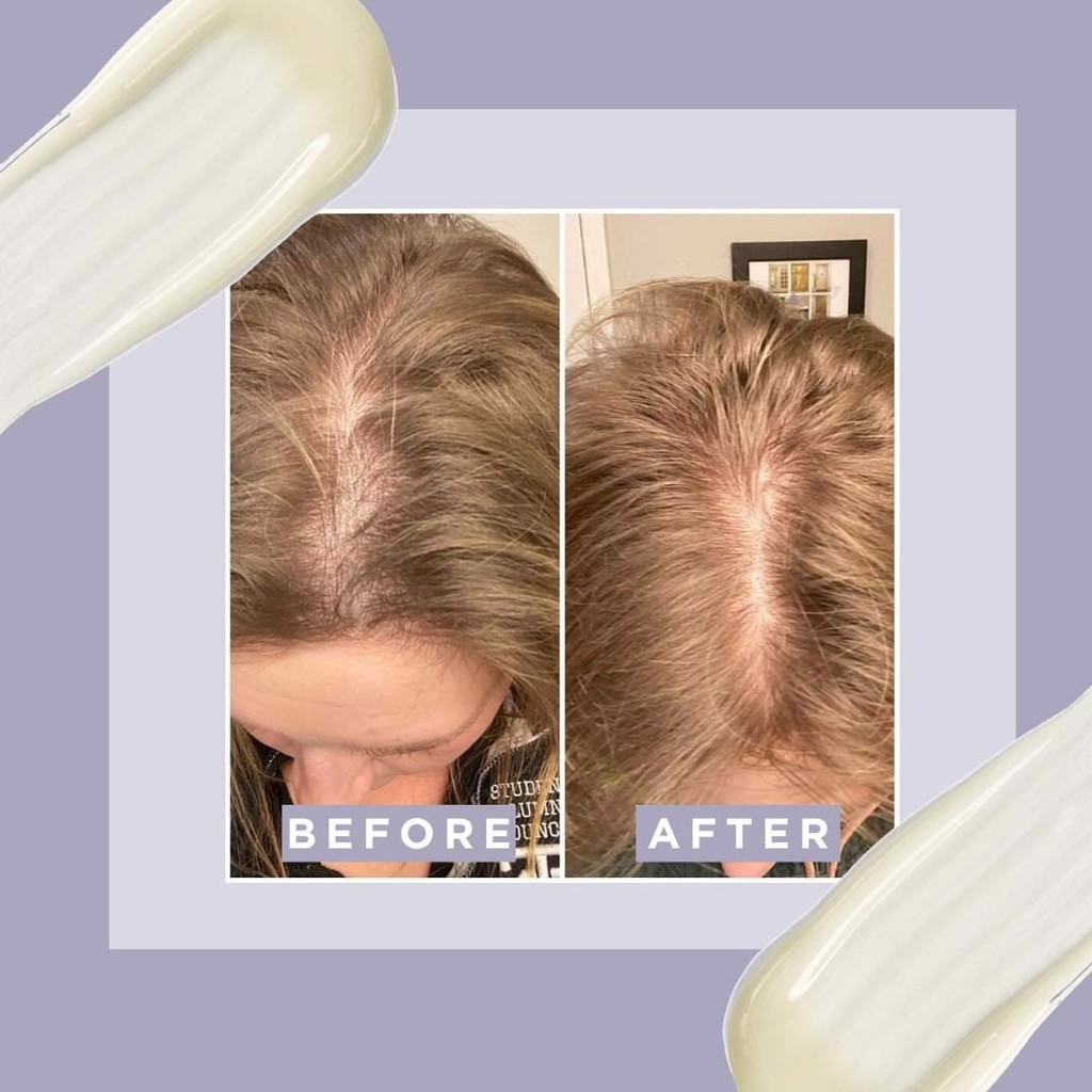Serum dưỡng dài tóc Grow Gorgeous Original Hair Density Serum For Fine Thinning Hair 60ml