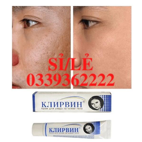 [ CHÍNH HÃNG ] Kem mờ sẹo Klirvin 25g của Nga Senabeauty