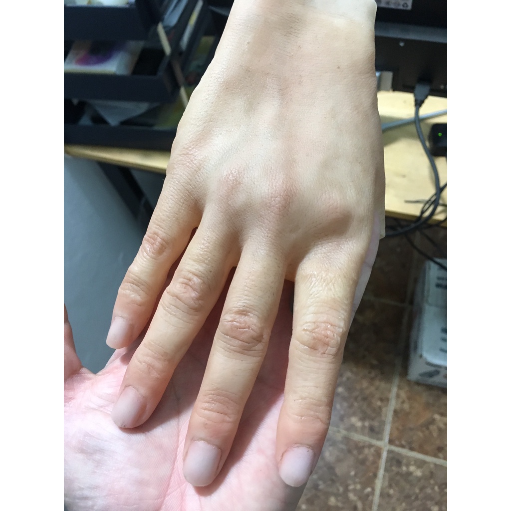 Ngón tay và bàn tay giả bằng silicone-MSP: BP0611