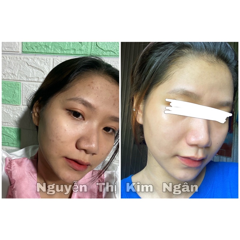 🌸SERUM HUNIE DƯỠNG DA SÁNG VÀ TỐI 🍓🐝 ‼️[ CAM KẾT CHÍNH HÃNG ] 𝐅𝐑𝐄𝐄𝐒𝐇𝐈𝐏 | BigBuy360 - bigbuy360.vn