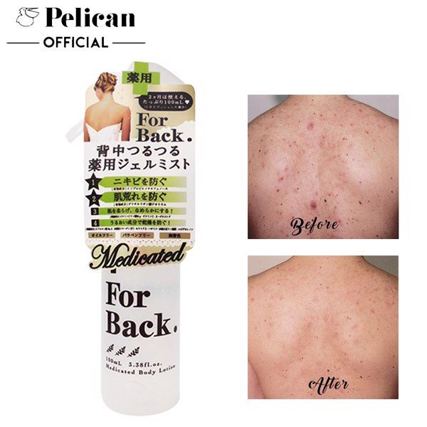 Xịt Giảm Mụn Lưng Pelican For Back Medicated Body Lotion 100ml