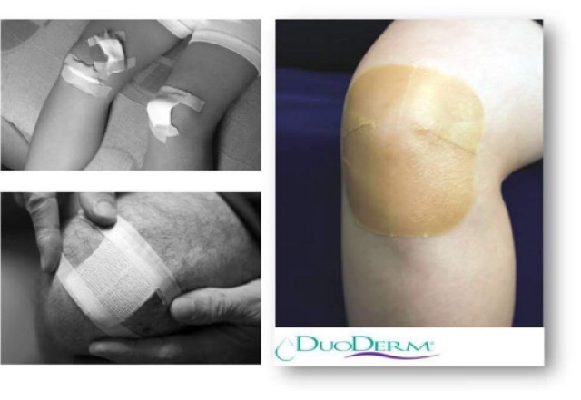 👉 Miếng dán mụn Duoderm Extrathin USA nk chính hãng | BigBuy360 - bigbuy360.vn