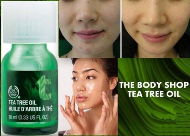 Tinh Dầu Trà The Body Shop Tea Tree Oil