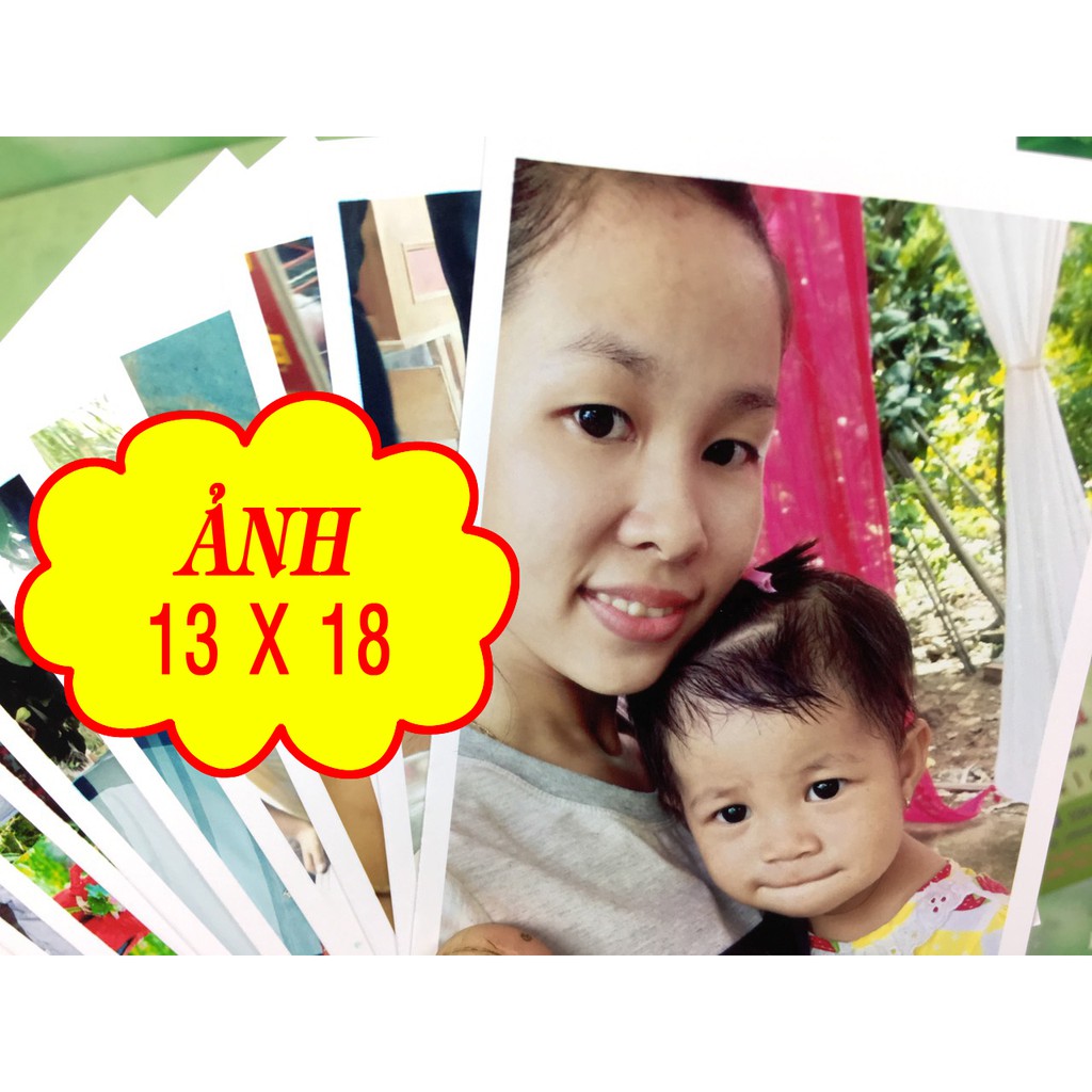 Combo 100 ảnh 13x18 + ep