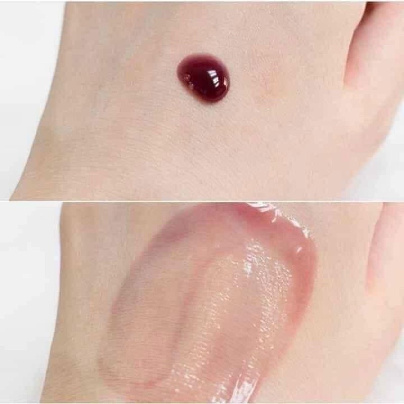 Gói red peel | BigBuy360 - bigbuy360.vn