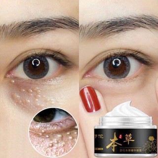 Kem mụn thịt quanh mắt ( cam kết chuẩn 100%) (shop_uytin88)