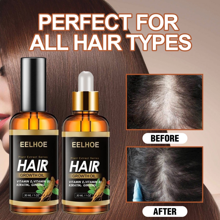 Tinh Dầu Gừng Kích Thích Mọc Tóc Và Chống Rụng Tóc