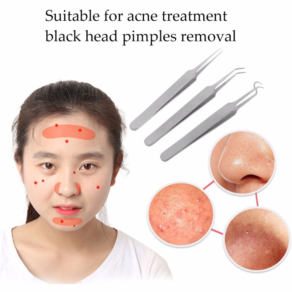 [Hàng mới về] Nhíp Nặn Mụn Đầu Đen / Mụn Trứng Cá Đầu Cong Độc Đáo Tiện Dụng