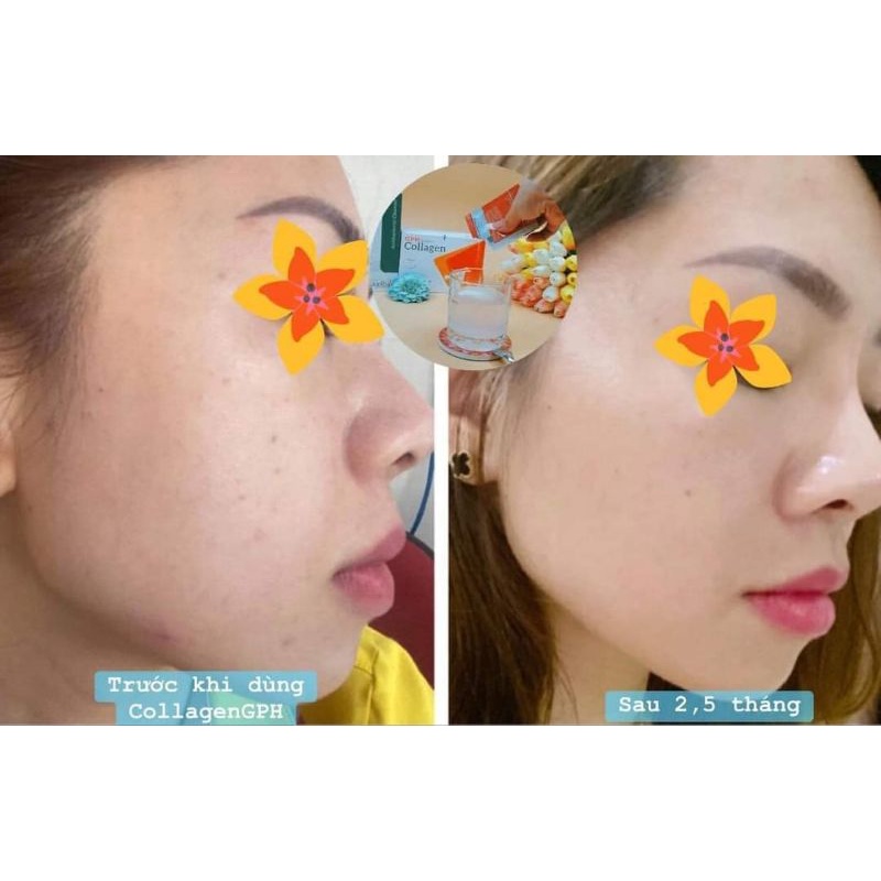 Collagen GPH up derma, uống đẹp da, sạm nám, tàn nhan, rụng tóc, săn chắc da, cân bằng nội tiết