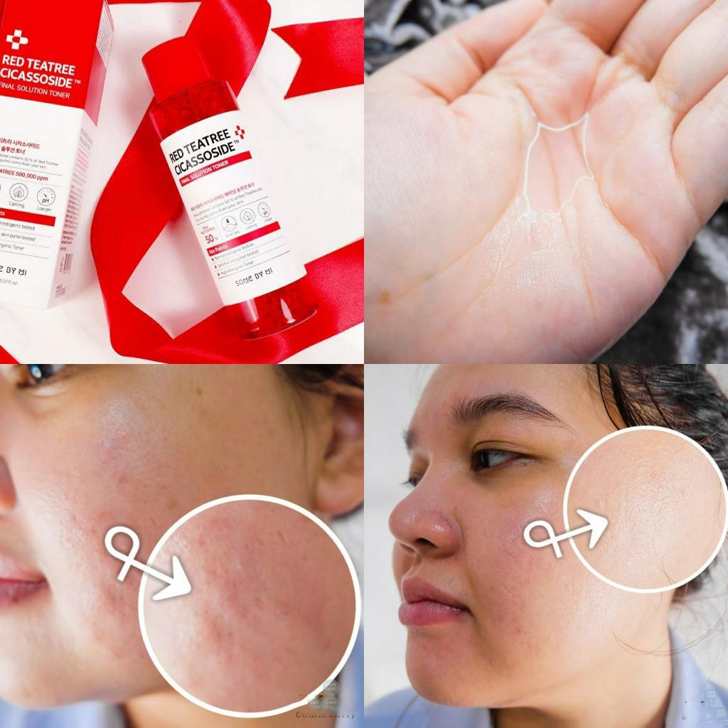 Some By Mi Red Tea Tree Toner - Nước hoa hồng Some By Mi