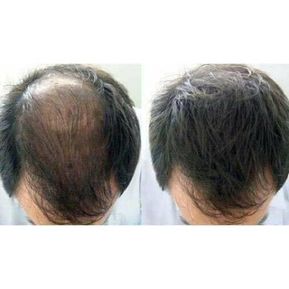 Serum MỌC RÂU-MỌC TÓC- MỌC LÔNG MÀY BEARD OIL-UAE