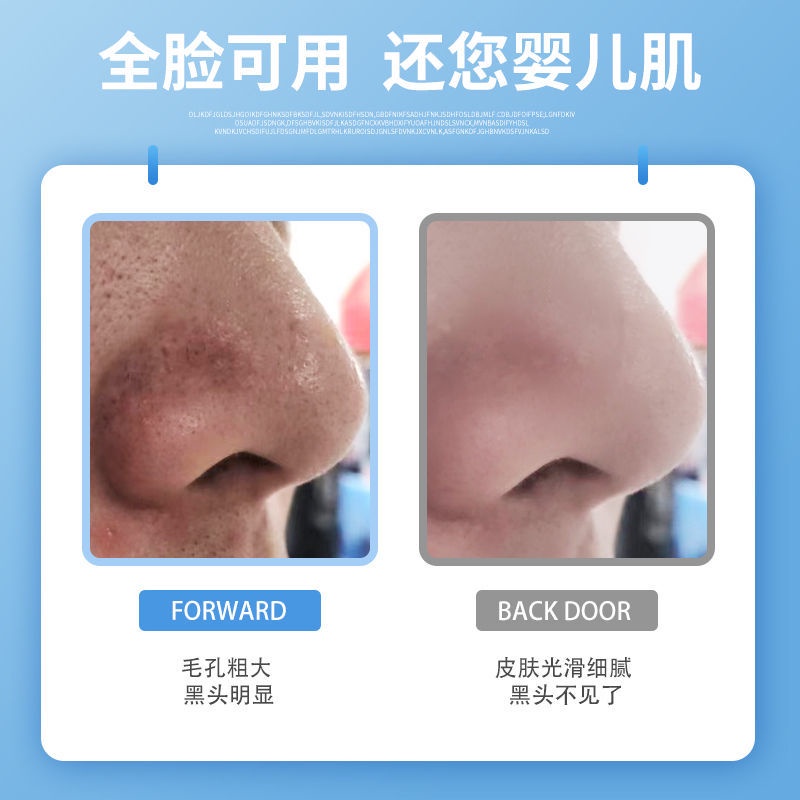 Mặt nạ lột mụn đầu đen thu nhỏ lỗ chân lông cho nam nữ | BigBuy360 - bigbuy360.vn