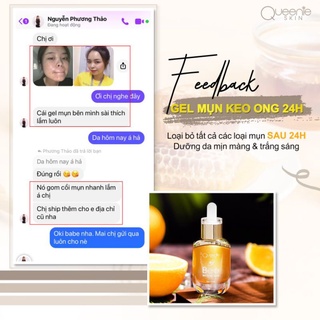[Chính Hãng] GEL MỤN KEO ONG 24H