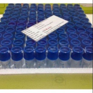 100 Ống chống đông máu edta,klc dùng trong công nghệ prp spa thẫm mỹ viện