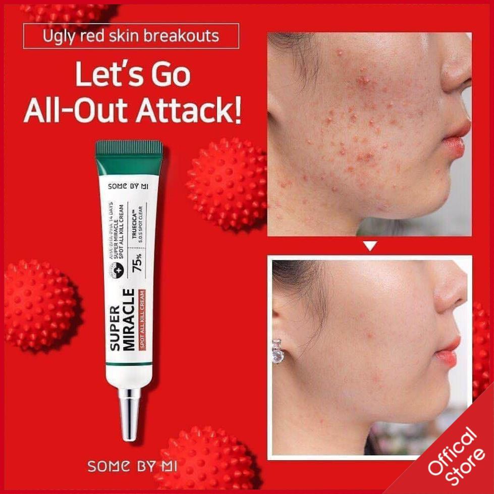 Kem mụn 14 ngày Some By Mi AHA-BHA-PHA 14 Days Super Miracle Spot All Kill Cream | BigBuy360 - bigbuy360.vn