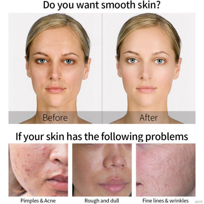 Serum Hyaluronic Acid MATRIXYL 3000 Vitamin C Giảm Nếp Nhăn Chăm Sóc Da Mặt 30ml