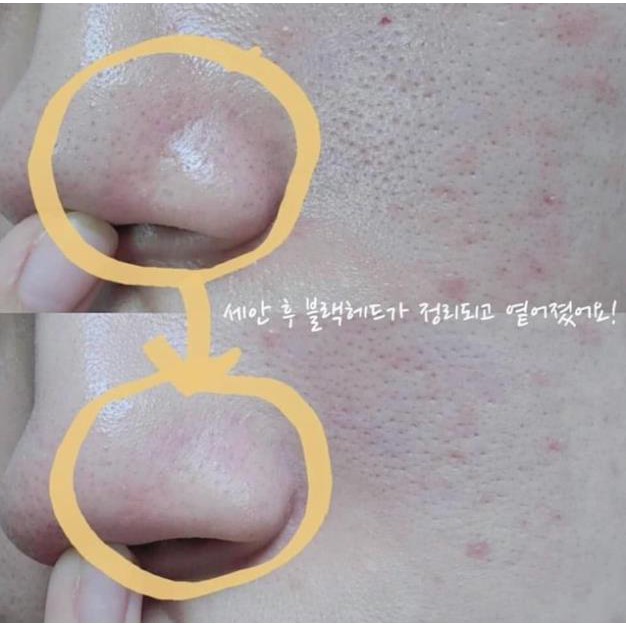 Sữa Rửa Mặt Innisfree Super Volcanic Pore Micellar Cleansing Foam 2x | BigBuy360 - bigbuy360.vn