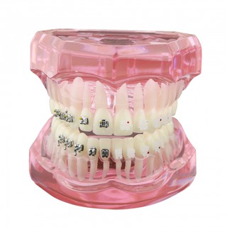 MÔ HÌNH TƯ VẤN CHỈNH NHA MẮC CÀI - MÔ HÌNH TƯ VẤN CHỈNH NHA NHA KHOA - MẪU HÀM 3003
